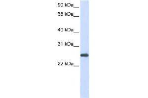 WB Suggested Anti-PRDX1 Antibody Titration:  0. (Peroxiredoxin 1 anticorps  (N-Term))
