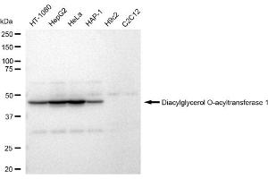 Western blotting analysis using Diacylglycerol O-acyltransferase 1 antibody (ABIN7798329).