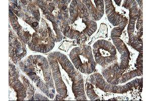 Image no. 9 for anti-Transmembrane Protein 173 (TMEM173) antibody (ABIN1501428)