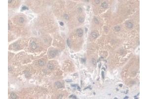 Detection of Nesp2 in Human Liver Tissue using Polyclonal Antibody to Nesprin 2 (Nesp2)