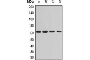 Western blot analysis of PPP3CA expression in Hela (A), A549 (B), mouse brain (C), mouse lung (D) whole cell lysates. (PPP3CA anticorps)