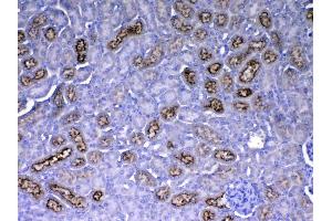 IHC analysis of RBP4 using anti-RBP4 antibody .