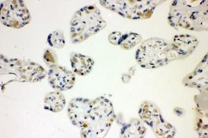 IHC analysis of CCNE1 using anti-CCNE1 antibody (ABIN7601193). (Cyclin E1 anticorps  (AA 3-386))