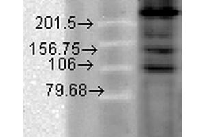 Western Blot analysis of Hamster T-CHO cell lysate showing detection of CaV1. (CACNA1C anticorps  (AA 1507-1733) (Atto 390))