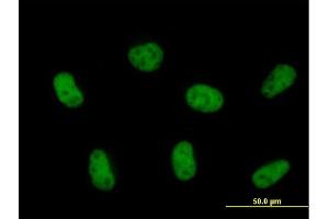 Immunofluorescence of purified MaxPab antibody to ZCCHC8 on HeLa cell.