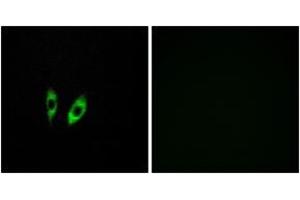 Immunofluorescence analysis of HeLa cells, using GPR156 Antibody. (GPR156 anticorps  (AA 501-550))