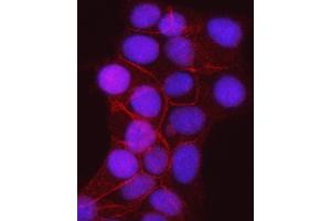 IF analysis of gamma Catenin using anti-gamma Catenin antibody (ABIN7602031). (JUP anticorps  (AA 556-745))