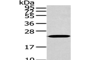 Western Blot analysis of 293T cells using ARL2 Polyclonal Antibody at dilution of 1/200 (ARL2 anticorps)