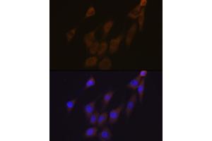 Immunofluorescence analysis of NIH-3T3 cells using Peroxiredoxin 4 (PRDX4) (PRDX4) Rabbit mAb (ABIN7269238) at dilution of 1:100 (40x lens).