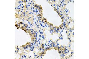 Immunohistochemistry of paraffin-embedded mouse lung using IGF1R antibody (ABIN5970073) at dilution of 1/100 (40x lens). (IGF1R anticorps  (N-Term))