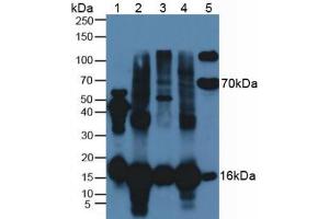 Western blot analysis of (1) Rat Serum, (2) Bovine Liver Tissue, (3) Bovine Heart Tissue, (4) Bovine Brain Tissue and (5) Bovine Serum. (SOD1 anticorps  (AA 2-154))
