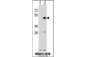 Western blot analysis of RBM22 using rabbit polyclonal RBM22 Antibody using 293 cell lysates (2 ug/lane) either nontransfected (Lane 1) or transiently transfected (Lane 2) with the RBM22 gene. (RBM22 anticorps  (AA 165-193))