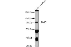 Western blot analysis of extracts of Mouse kidney, using DVL1 antibody (ABIN7266796) at 1:1000 dilution. (DVL1 anticorps  (AA 510-640))
