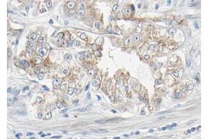 AF3132 at 1/100 staining human Prostate tissue sections by IHC-P. (PDGFRB anticorps  (pTyr1021))