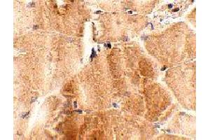 Immunohistochemistry of JPH2 in mouse skeletal muscle tissue with JPH2 polyclonal antibody  at 2. (Junctophilin 2 anticorps  (C-Term))