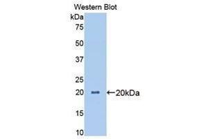 Western Blotting (WB) image for anti-Angiopoietin-Like 4 (ANGPTL4) (AA 227-389) antibody (ABIN1174068) (ANGPTL4 anticorps  (AA 227-389))