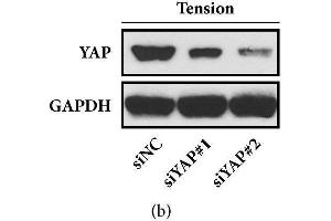 Cyclic stretch-induced osteogenesis was weakened in the YAP-depleted HPDLCs.