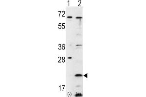 Western Blotting (WB) image for anti-Frataxin (FXN) antibody (ABIN3002642) (Frataxin anticorps)