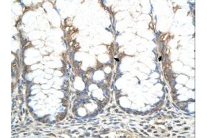 CHIC2 antibody was used for immunohistochemistry at a concentration of 4-8 ug/ml. (CHIC2 anticorps  (N-Term))