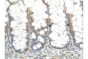 CHIC2 antibody was used for immunohistochemistry at a concentration of 4-8 ug/ml.
