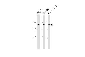 PSMB2 Antibody (C-term) (ABIN1881696 and ABIN2843611) western blot analysis in PC-3 cell line,mouse liver and rat stomach tissue lysates (35 μg/lane).