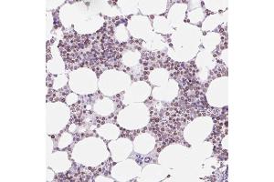 Immunohistochemical staining (Formalin-fixed paraffin-embedded sections) of human bone marrow with VPREB1 polyclonal antibody  shows moderate nuclear membrane positivity in hematopoietic cells. (VPREB1 anticorps  (AA 20-138))