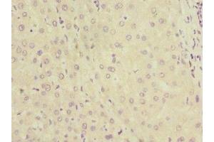 Immunohistochemistry of paraffin-embedded human liver tissue using ABIN7157750 at dilution of 1:100 (KYNU anticorps  (AA 1-307))