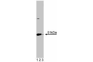 Western blot analysis of Annexin VII on a human endothelial cell lysate.