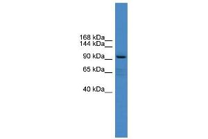 WB Suggested Anti-XYLT1 Antibody Titration:  0. (XYLT1 anticorps  (Middle Region))