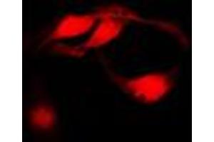 Immunofluorescent analysis of CHK1 staining in HeLa cells.
