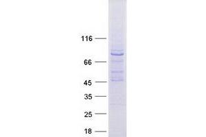 MTO1 (Transcript Variant 2) protein (Myc-DYKDDDDK Tag)