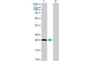 Western Blot analysis of PPCDC expression in transfected 293T cell line by PPCDC MaxPab polyclonal antibody.