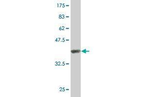 Western Blot detection against Immunogen (38.