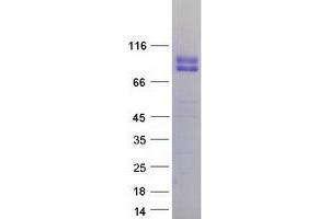 Validation with Western Blot