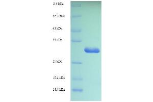 SDS-PAGE of protein expressed in E.
