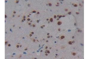 Detection of KHDRBS1 in Mouse Brain Tissue using Polyclonal Antibody to KH Domain Containing, RNA Binding, Signal Transduction Associated Protein 1 (KHDRBS1)