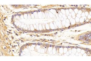 Detection of TUBb in Human Colon Tissue using Monoclonal Antibody to Tubulin Beta (TUBb)
