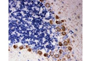 IHC-P: DISC1 antibody testing of rat cerebellum tissue (DISC1 anticorps  (Middle Region))