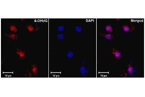 Immunohistochemistry analysis using Mouse Anti-DNA Damage Monoclonal Antibody, Clone 15A3 . (DNA/RNA Damage anticorps (APC))