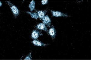 Immunofluorescence staining of HeLa cells (Human cervical epitheloid carcinoma, ATCC CCL-2. (XRCC4 anticorps  (AA 53-168))