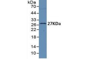 Mouse Detection antibody from the kit in WB with Positive Control: Sample Human serum.