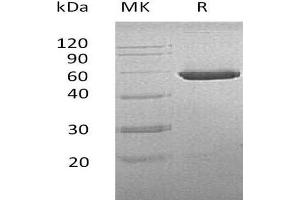 Western Blotting (WB) image for CNDP Dipeptidase 2 (Metallopeptidase M20 Family) (CNDP2) protein (His tag) (ABIN7320732)