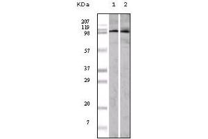 Western Blotting (WB) image for anti-Ephrin Type A Receptor 1 (EPHA1) (truncated) antibody (ABIN2464049) (EPHA1 anticorps  (truncated))