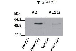 Western blot detection of insoluble phospho-Tau protein using the anti-Tau (Ser 208/210) antibody in samples isolated from patients with a neurodegenerative disease (Amyotropic lateral sclerosis, ALS or Alzheimer’s disease, AD (tau anticorps  (pSer208, pSer210))
