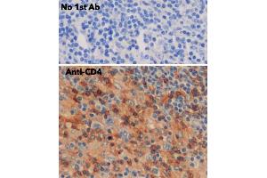 IHC of human lymph node using anti-CD4 antibody and FFPE tissue after heat-induced antigen retrieval.