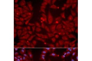Immunofluorescence analysis of U2OS cells using GRIK2 Polyclonal Antibody (GRIK2 anticorps)