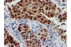 Image no. 13 for anti-F-Box Protein 21 (FBXO21) antibody (ABIN1498235)