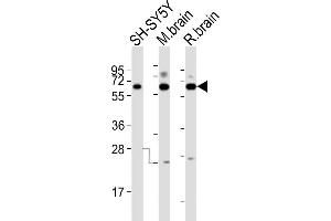All lanes : Anti-DPYSL5 Antibody (C-term) at 1:2000 dilution Lane 1: SH-SY5Y whole cell lysates Lane 2: mouse brain lysates Lane 3: rat brain lysates Lysates/proteins at 20 μg per lane. (DPYSL5 anticorps  (C-Term))