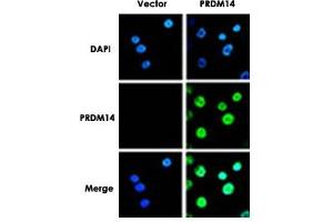 Immunofluorescence analysis of PRDM14 in breast cancer cells. (PRDM14 anticorps  (N-Term))