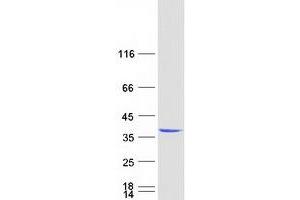 Validation with Western Blot